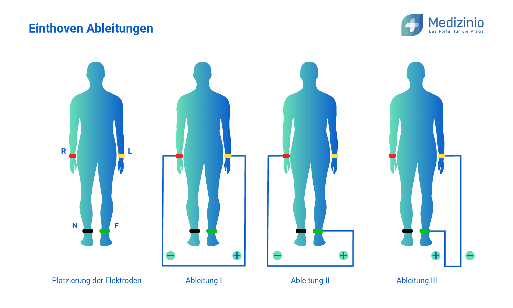 12 Kanal EKG Anlegen Anleitung Bilder Video